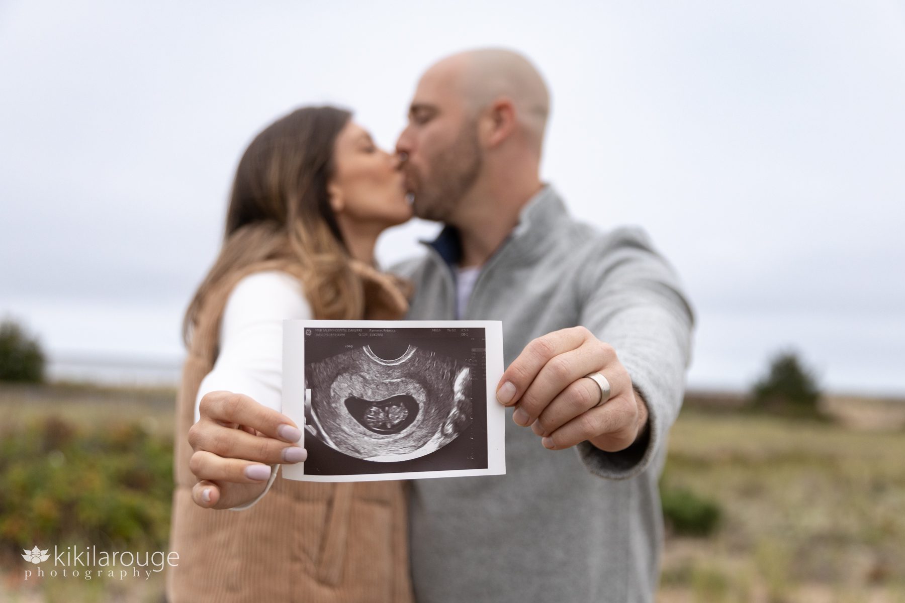 Couple holding an ultrasound kissing in the backdrop at the beach